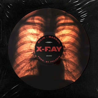 X-Ray